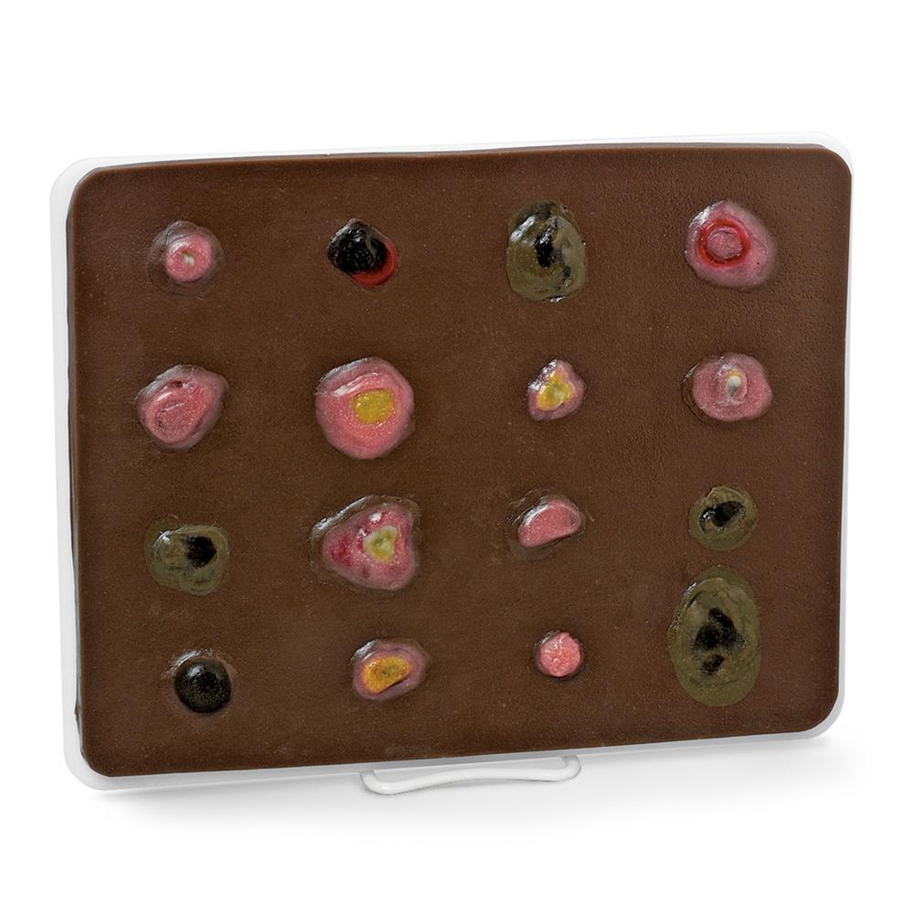 Dark Skin Cancer Trainer - Enlarged Model for Medical Education & Training | Perfect for Dermatology Students, Doctors & Skin Cancer Awareness Programs