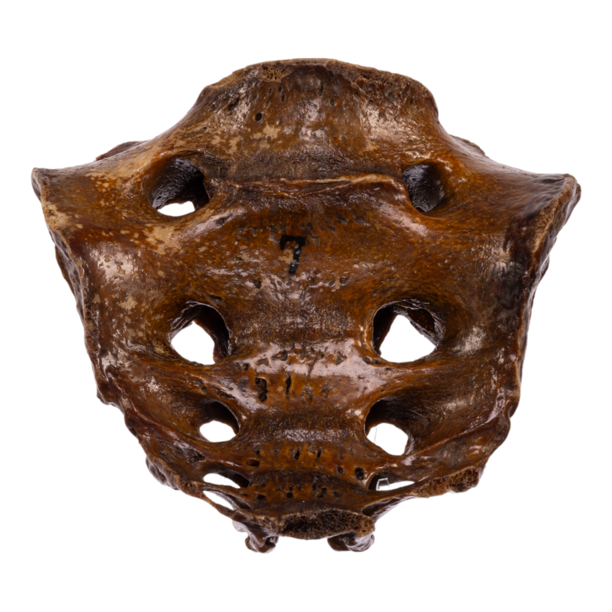 Antique Real Human Sacrum Bone - Medical Specimen, Anatomy Study, Gothic Decor, Halloween Prop