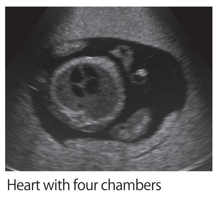 Fetal Ultrasound Training Phantom - High-Quality SPACE FAN ST Model for Medical Education & Diagnostic Practice | Perfect for OB/GYN Simulation & Sonography Training