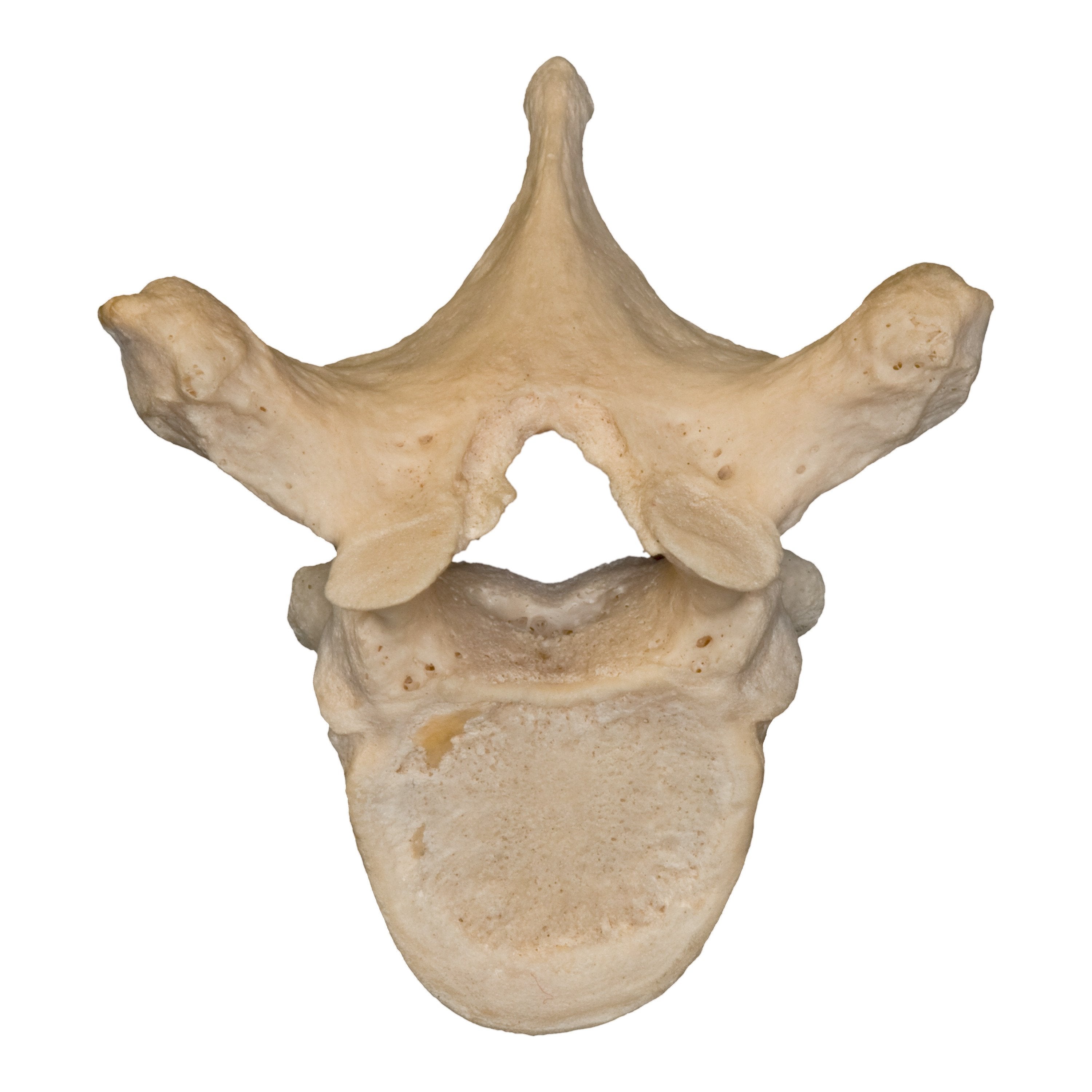 Authentic Human Thoracic Vertebra - Single Bone Specimen for Medical Study, Anatomy Education & Research