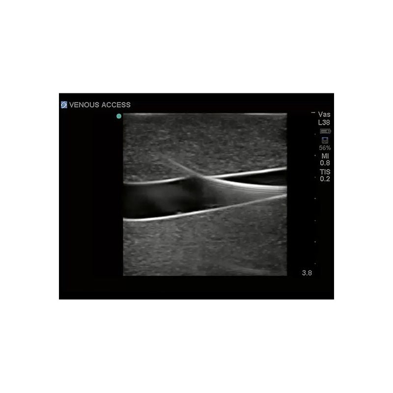 Gen II Central Line and Regional Anesthesia Replacement Insert - Sterile Medical Catheter for IV Therapy & Pain Management in Hospitals & Clinics