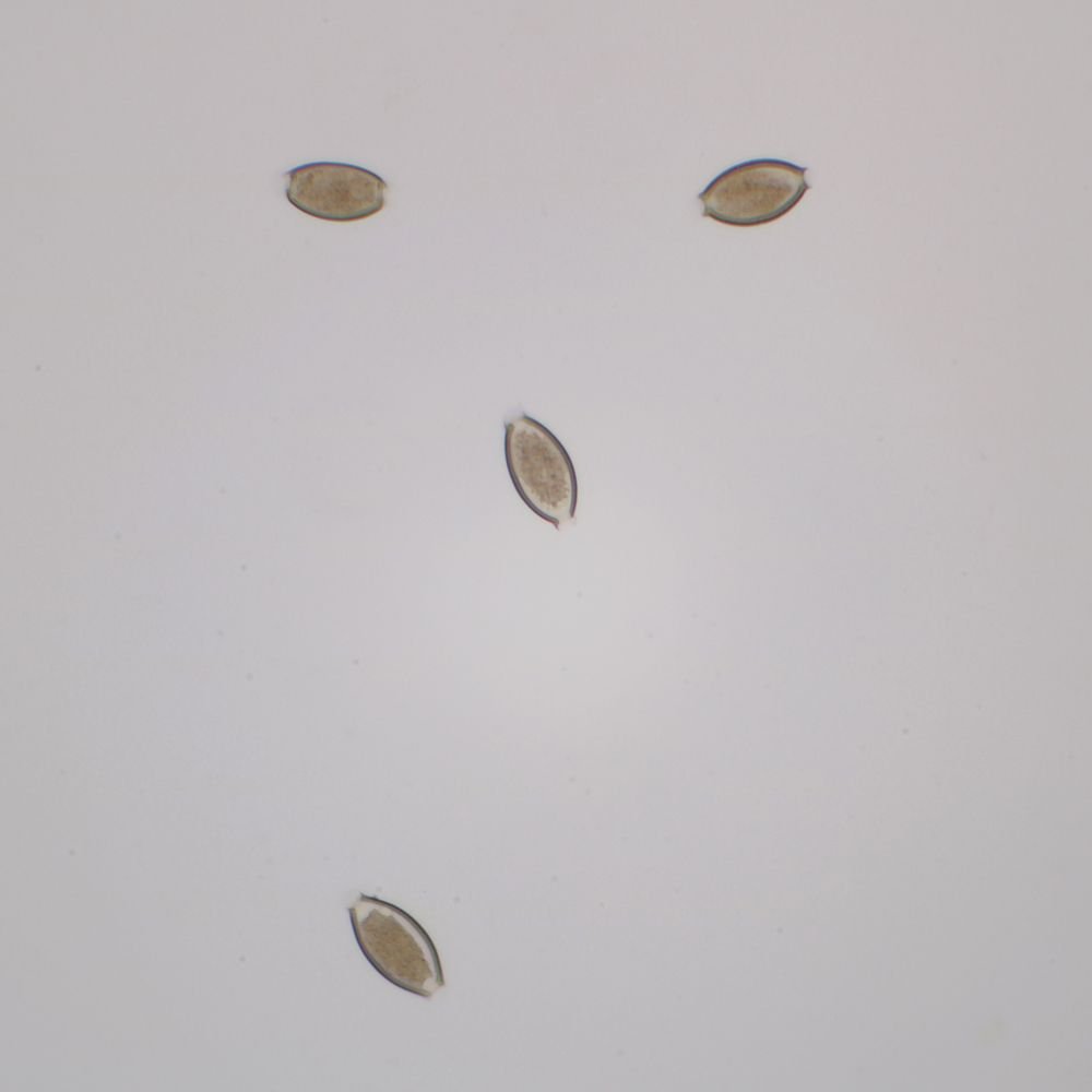 Trichuris Trichiura Eggs Whole Mount Microscope Slide - Parasitology Study Specimen for Lab Research & Medical Education