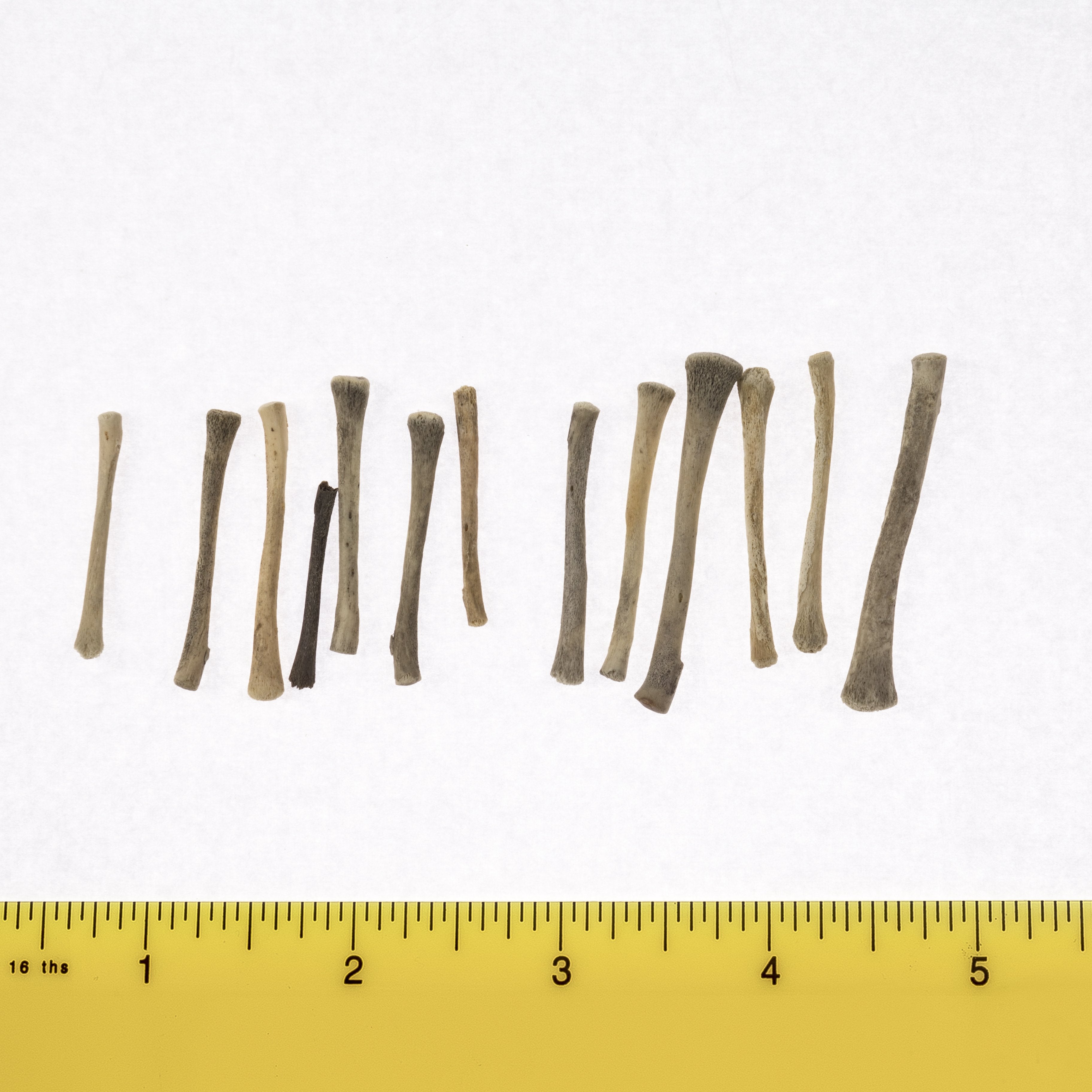 High-Quality Human Fetal Radius Bone Specimen for Medical Research & Education - Ideal for Anatomy Studies, Medical Training, and Forensic Analysis