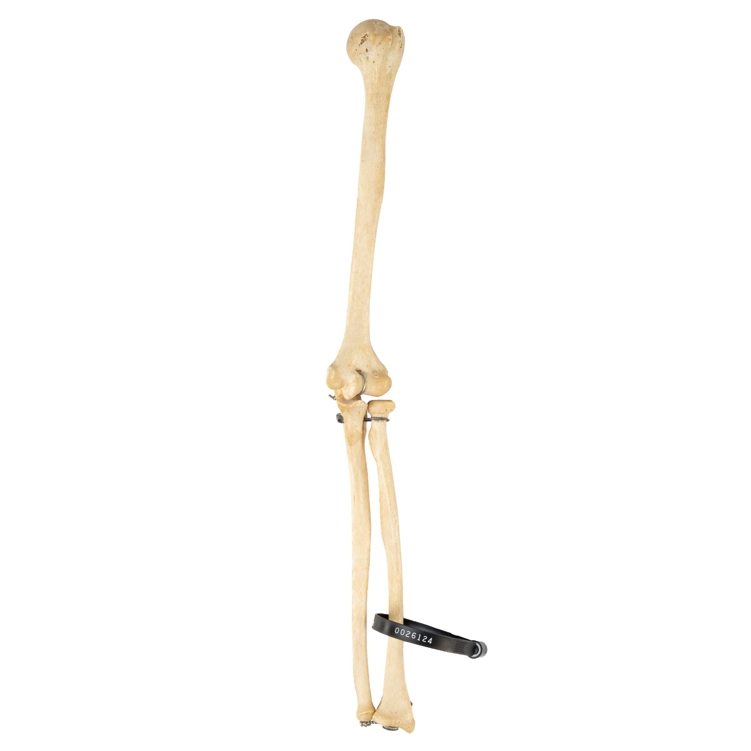 Authentic Human Humerus, Radius & Ulna Bones - Medical Education, Anatomy Study & Science Classroom Specimen