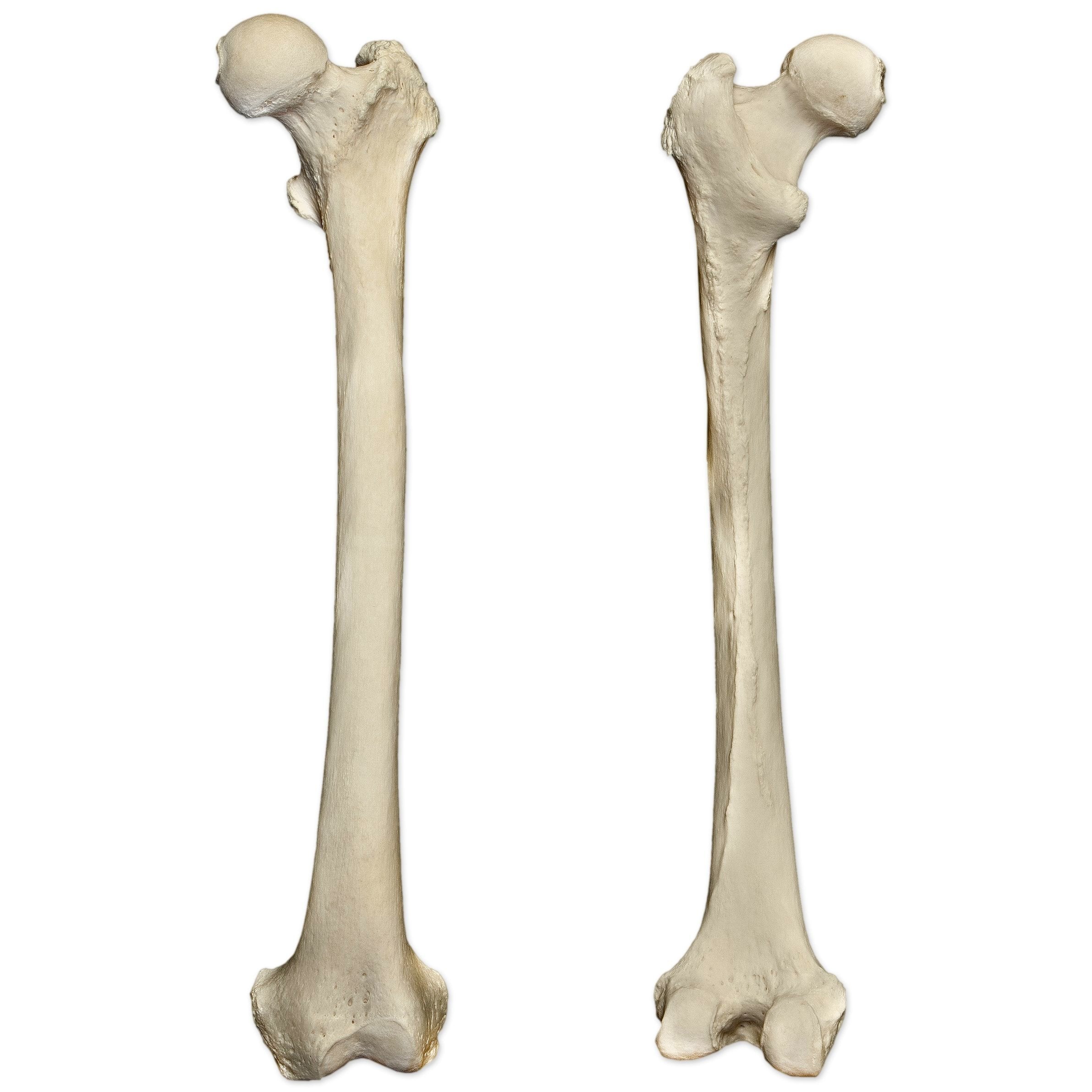 Authentic Real Human Femur Bone - Medical Specimen, Anatomy Study, Educational Display - Perfect for Medical Schools, Science Labs & Halloween Decor