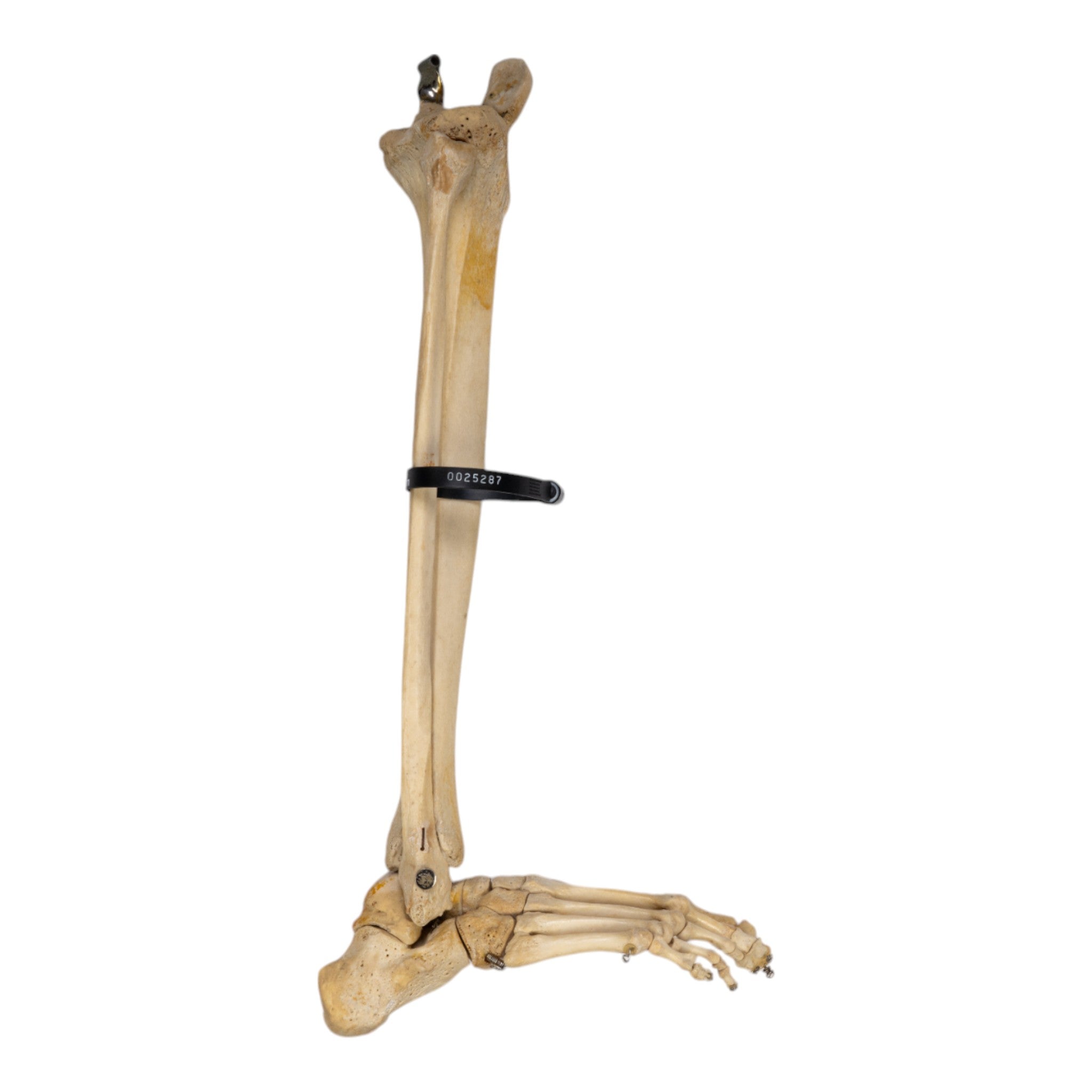 Realistic Human Right Leg Prosthetic - Partial & Articulated for Medical Training, Amputee Rehabilitation & Anatomy Study