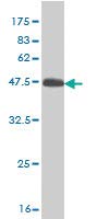 Anti-RHEB Mouse Monoclonal Antibody [Clone 1000000000000] - 100µG for Immunohistochemistry, Western Blot & ELISA - Lab Research & Diagnostics Use