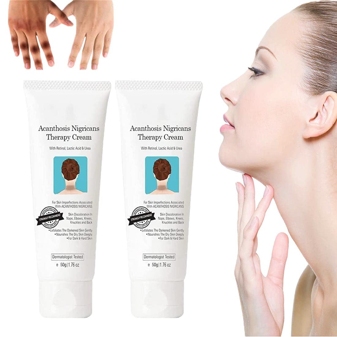 Nigrifree Acanthosis Nigricans Therapy Cream - Dark Spot Corrector & Whitening Serum for Body, Elbows, Knees, Underarms, Bikini Area & Neck - 2 Pack | Skin Brightening Treatment for Hyperpigmentation | Perfect for Daily Use & Post-Sun Care