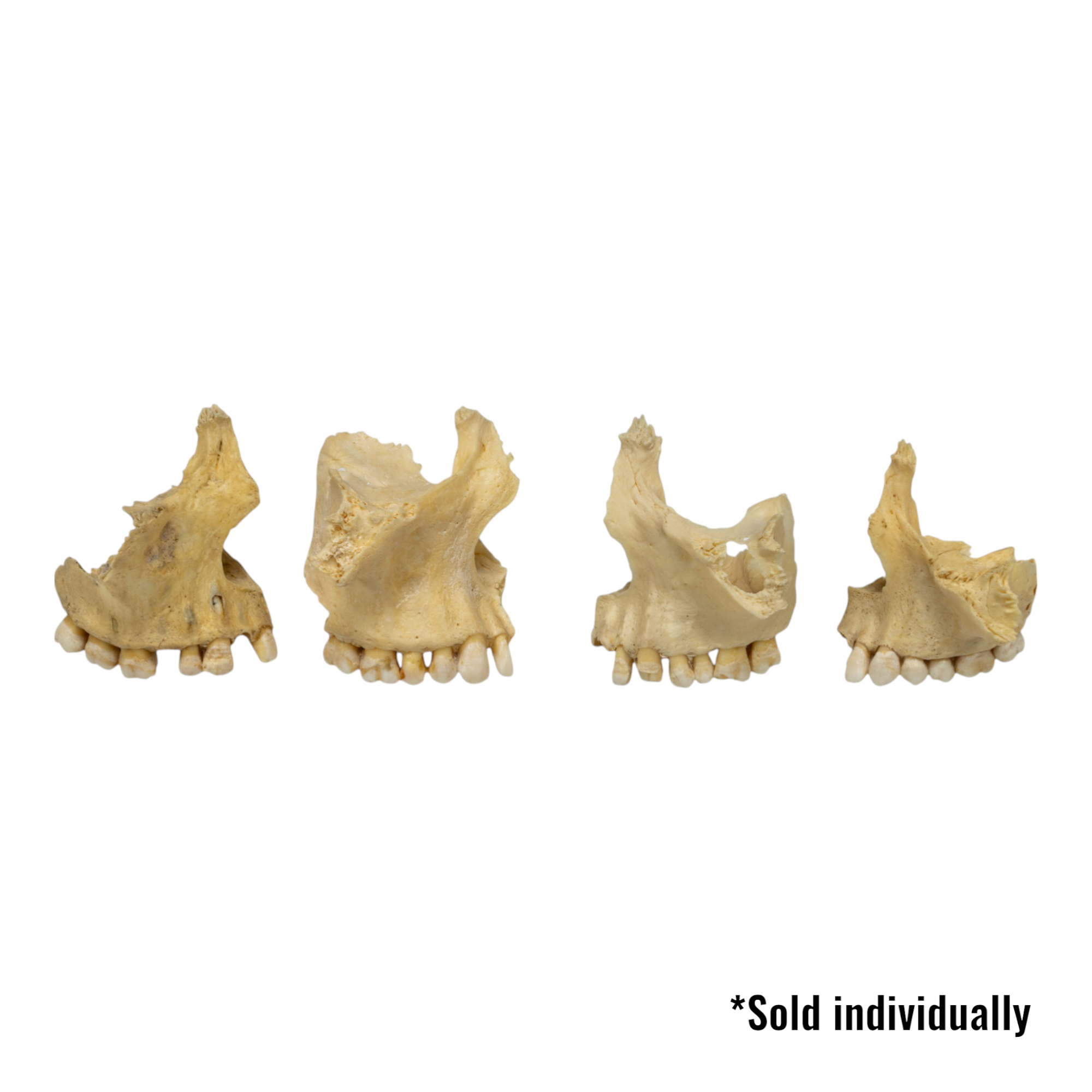 Authentic Human Maxillary Bone - Single Specimen for Medical Study, Dental Education, and Anatomy Research | Ideal for Students, Doctors, and Science Enthusiasts