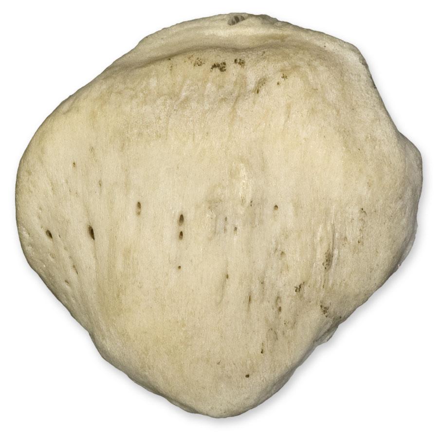 Real Human Patella Bone Model - Anatomical Knee Joint Specimen for Medical Study, Education & Display | Perfect for Doctors, Students & Anatomy Enthusiasts