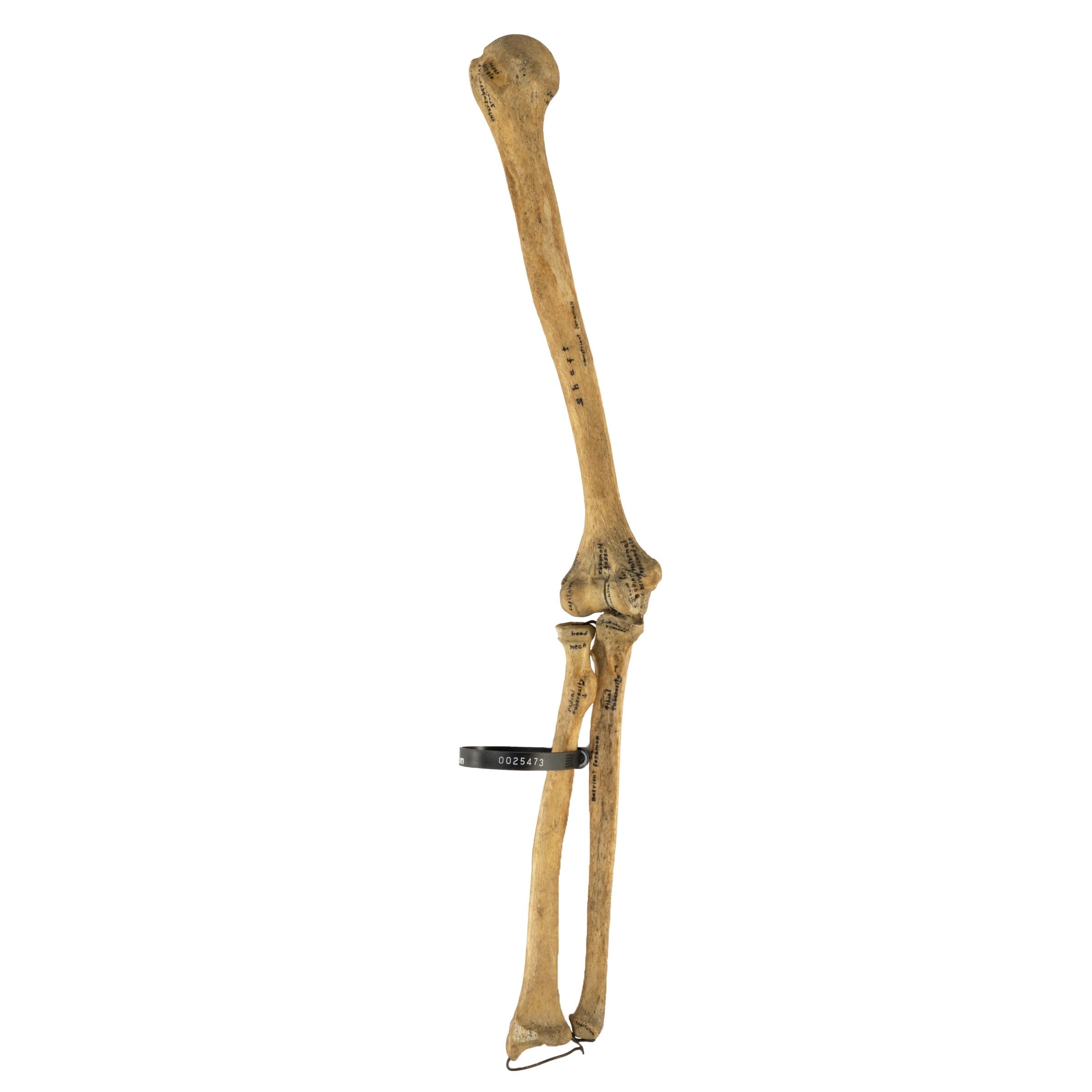 Authentic Human Humerus, Radius & Ulna Bones - Medical Study, Anatomy Education & Science Classroom Specimen