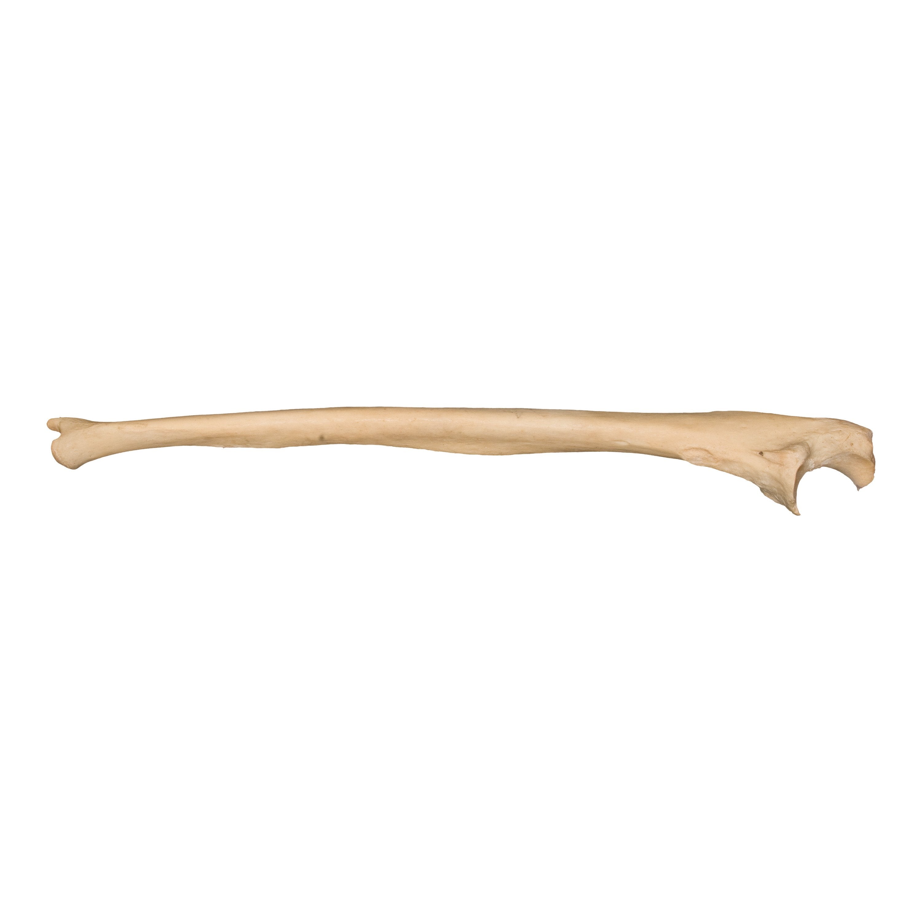 Authentic Real Human Ulna Bone - 15cm for Medical Study, Anatomy Education & Halloween Decor | Perfect for Doctors, Students & Collectors