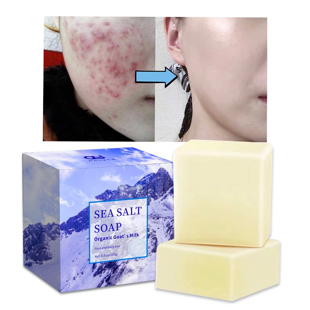 **Organic Goat's Milk & Natural Sea Salt Bar Soap – 3.5 Oz Each (2-Pack, 7 oz) – Deep Cleansing for Acne, Pores & Problem Skin – Gentle Face, Body & Hand Wash for Men & Women – Ideal for Sensitive, Oily & Dry Skin | Perfect for Daily Skincare & Spa Relaxation**