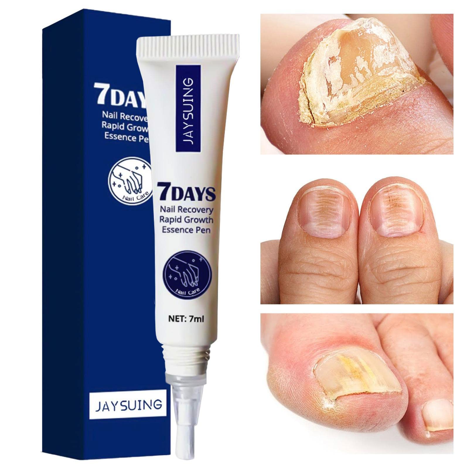 Nail Growth Oil & Repair Solution - 7ml Natural Nail Conditioner for Stronger Nails | Quick Nail Care Treatment for Dry, Brittle Nails | Perfect for Manicures, Nail Salons & At-Home Nail Care