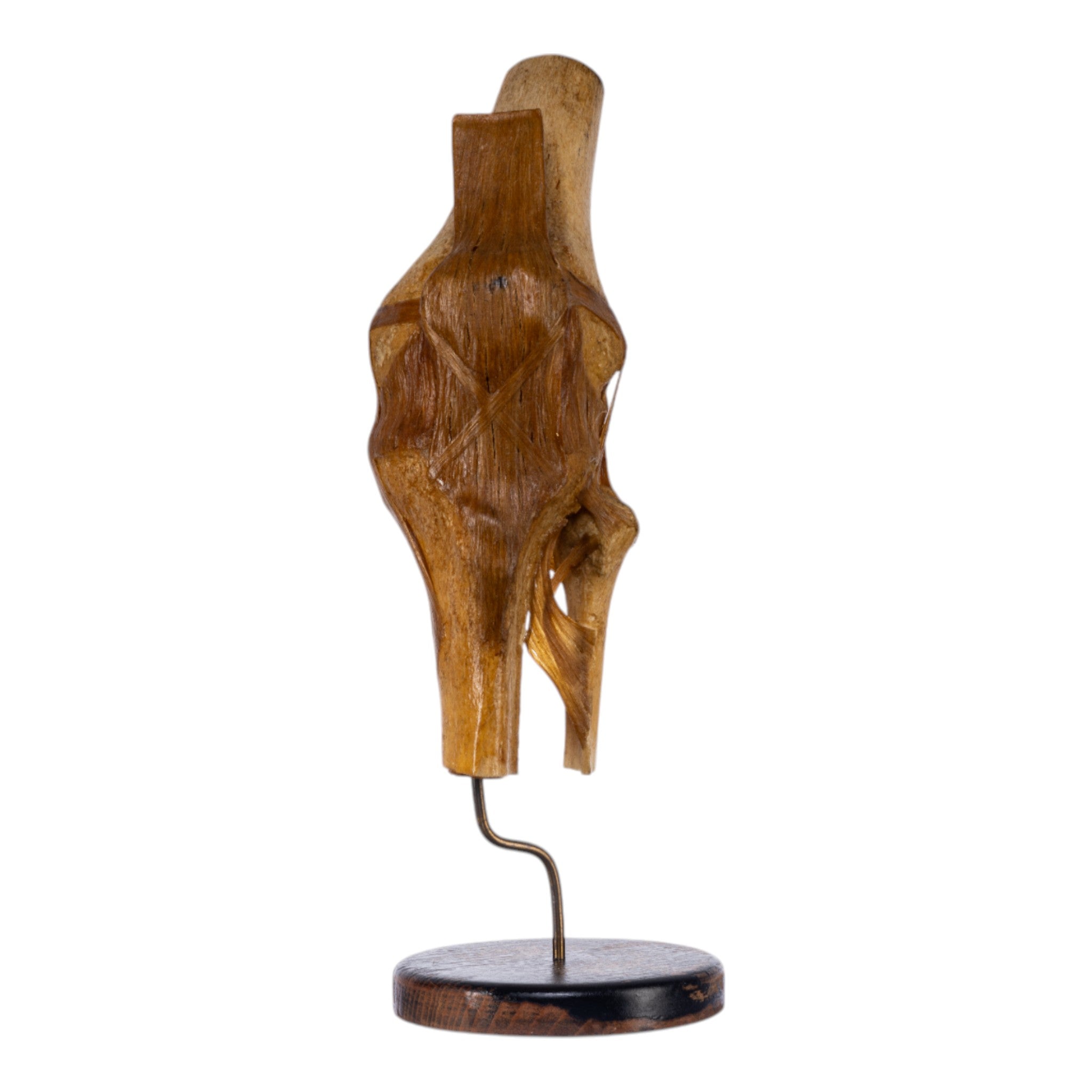 Real Human Knee Joint Anatomical Model with Stand - Perfect for Medical Education, Anatomy Study, and Classroom Demonstrations