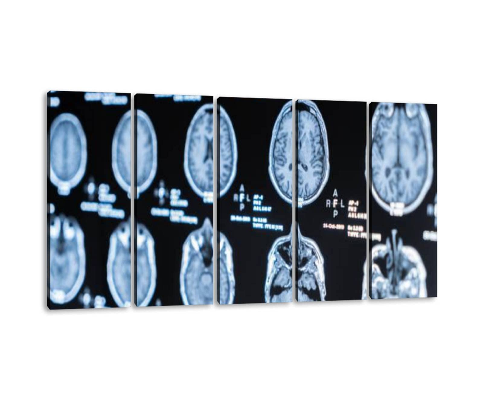 5 Panels Modern Cat Scan Art Wall Decor - Human Head Examination Treatment Canvas Prints - Framed Painting Ready to Hang (60''Wx32''H) - Perfect for Office, Bedroom & Home Decor - Ideal for Medical Offices, Hospitals & Science Enthusiasts