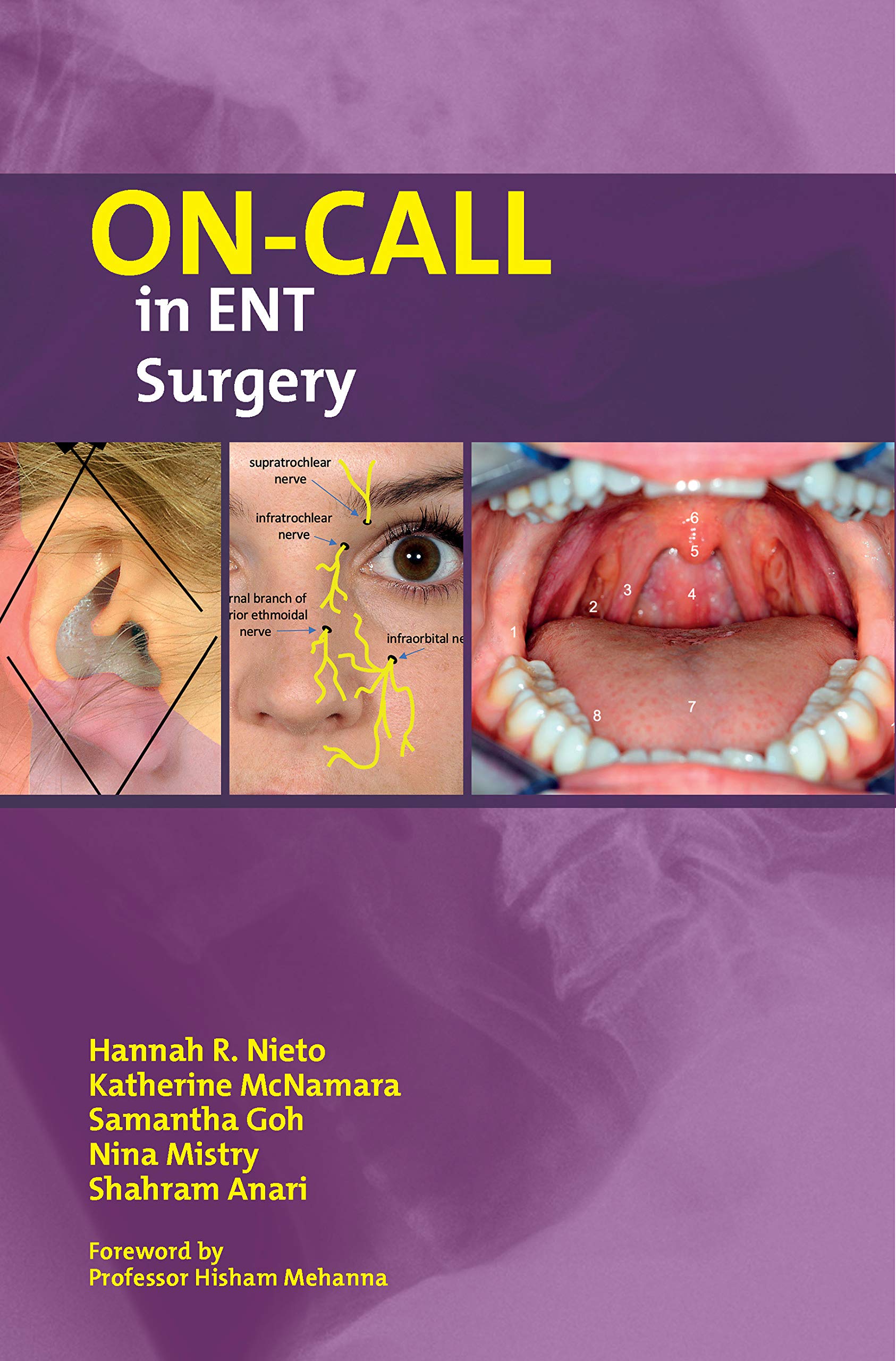 On-Call in ENT Surgery: Essential Guide for Emergency Procedures - Perfect for Medical Students & ENT Residents (On-Call Series)
