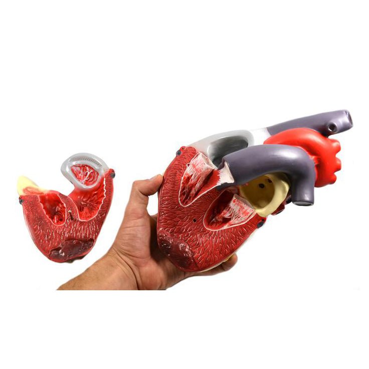 Heart Disease Symptoms, Causes & Treatments - Guide to Cardiovascular Conditions | For Patients & Healthcare Professionals