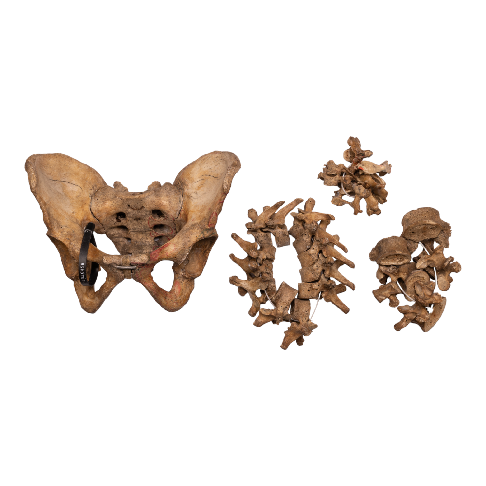 Authentic Human Spine, Sacrum & Pelvis Model - Medical Anatomy Study, Chiropractic Training, Classroom Demonstration