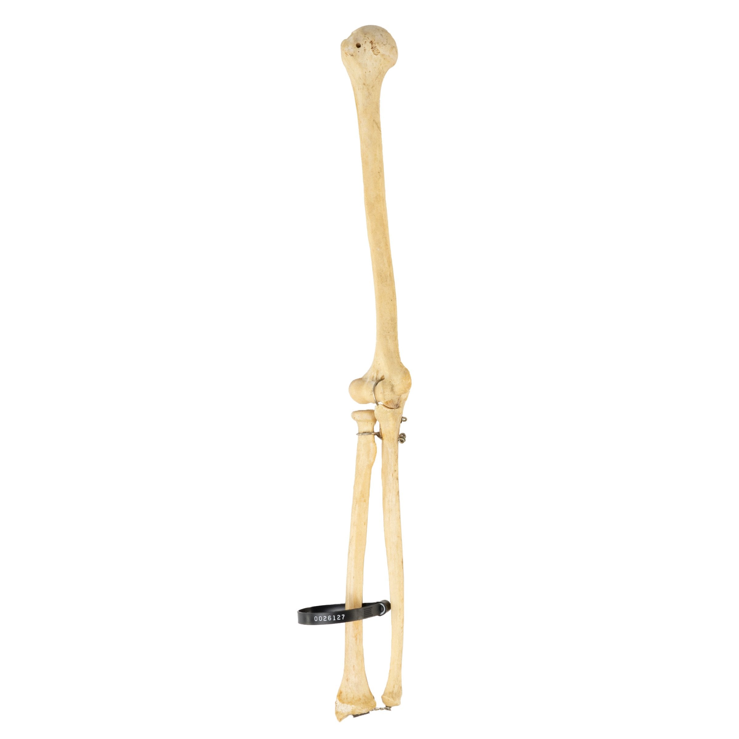 Authentic Human Humerus, Radius & Ulna Bones - Medical Study, Anatomy Education & Science Classroom Specimen