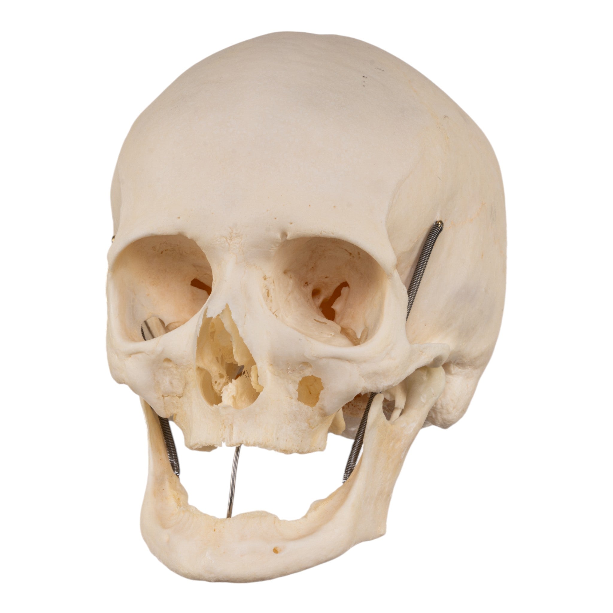 Premium Human Skull Model for Medical Research & Pathology Studies - Ideal for Anatomy Labs, Medical Training & Educational Use