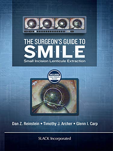 **The Surgeon's Guide to SMILE: Small Incision Lenticule Extraction - Step-by-Step Techniques for Refractive Eye Surgery | LASIK Alternative for Vision Correction**    *(Use Cases: Ideal for ophthalmologists, eye surgeons, and medical students learning advanced refractive surgery techniques.)*