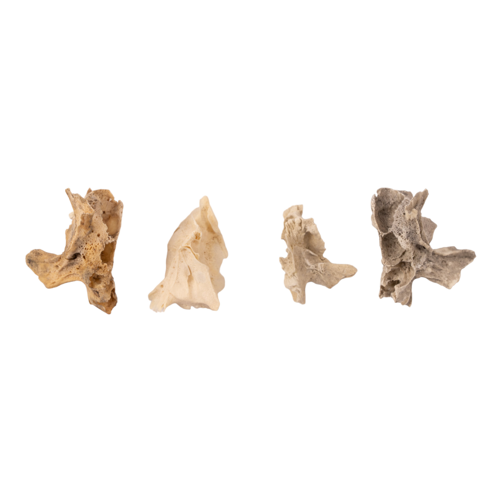 Premium Human Fetal Half Maxilla Specimen for Medical Research - High-Quality Anatomical Study Material for Dental, Craniofacial, and Developmental Biology Research (Ideal for Universities, Labs, and Medical Training)