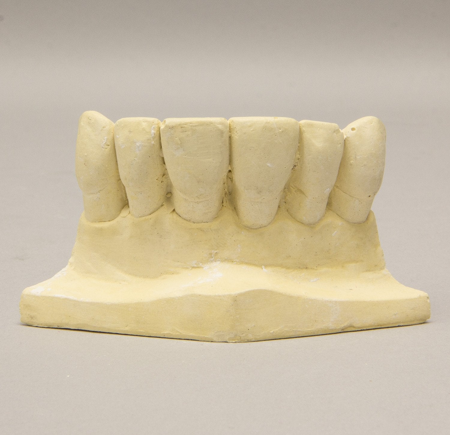 High-Quality Replica Orthodontic Study Model - Durable Dental Training Teeth for Students & Professionals | Perfect for Dental Schools, Clinics & Practice Sessions