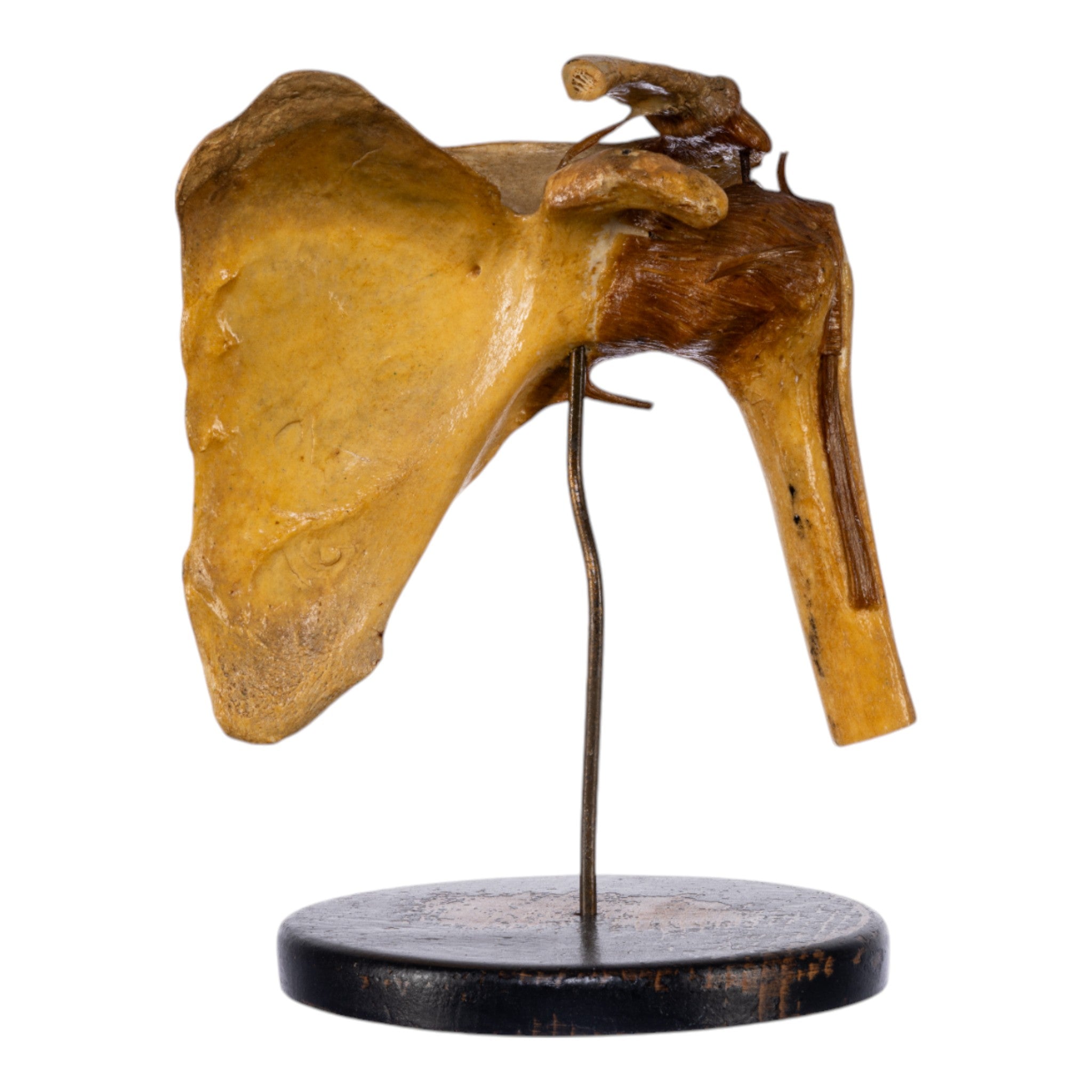 Real Human Left Shoulder Joint Anatomical Model on Stand - Medical Education, Orthopedic Study & Classroom Demonstration