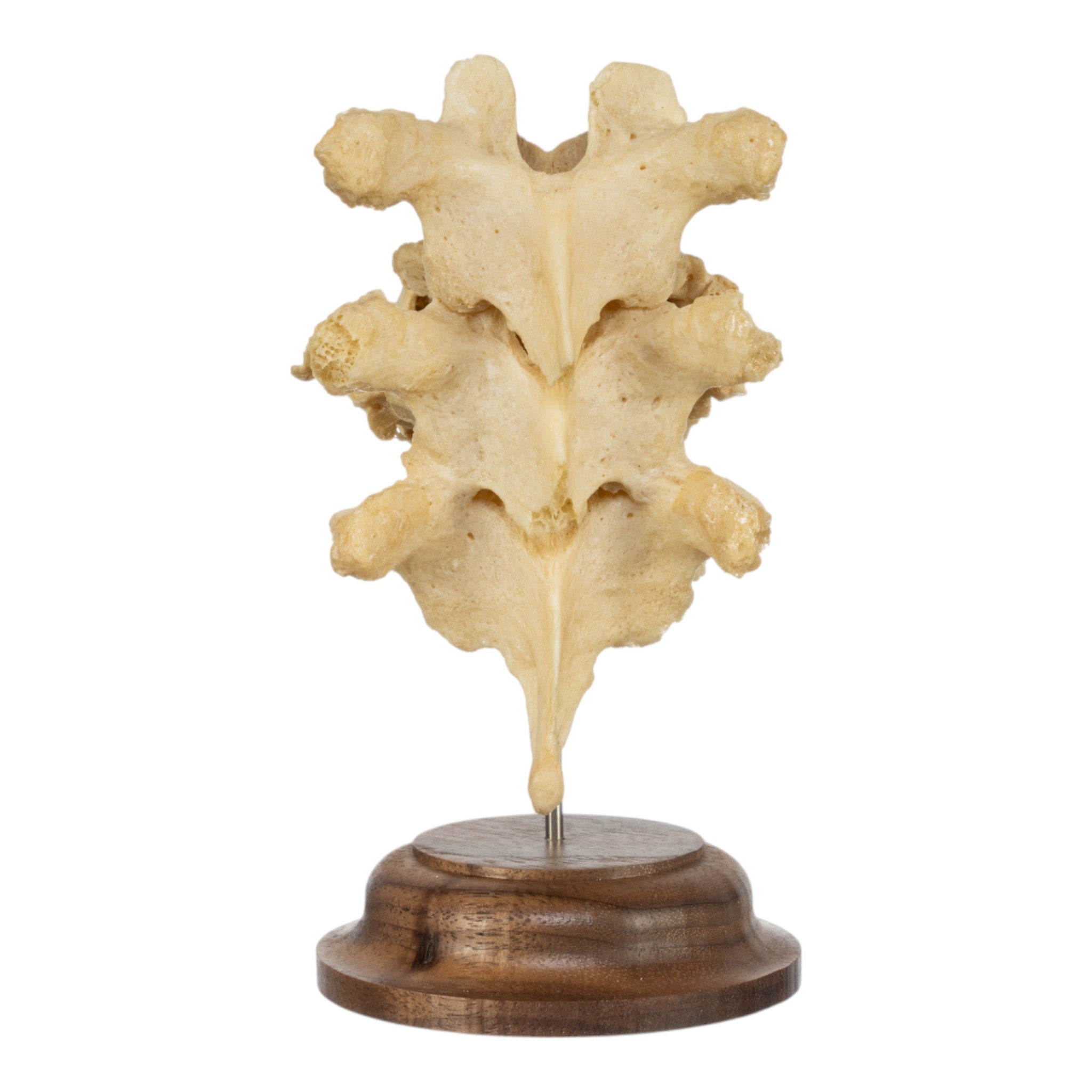 Authentic Human Fused Vertebrae Specimen - Medical Educational Display for Anatomy Study, Classroom Teaching & Doctor's Office Decoration