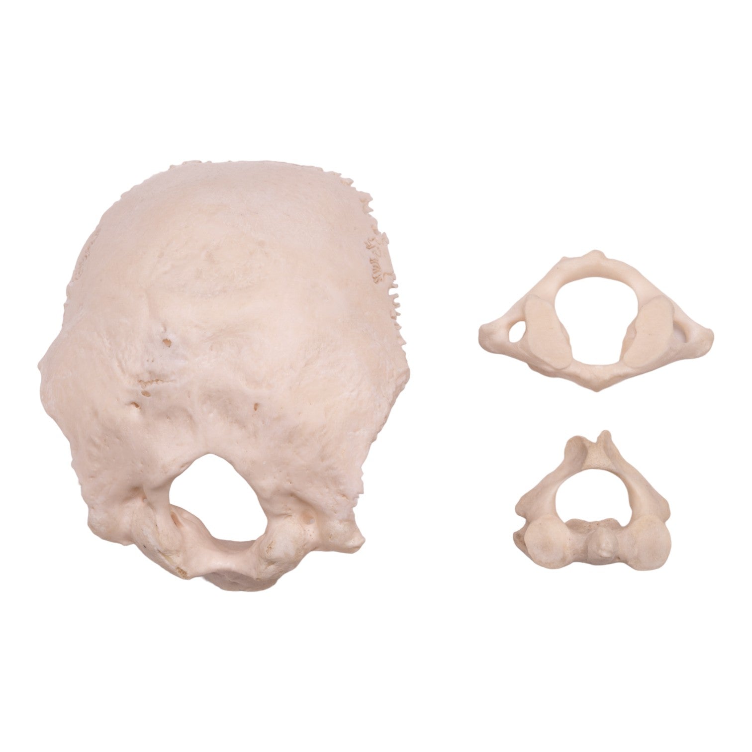 Authentic Human Occipital Bone, Atlas & Axis Vertebrae Set - Medical Study, Anatomy Education & Forensic Research