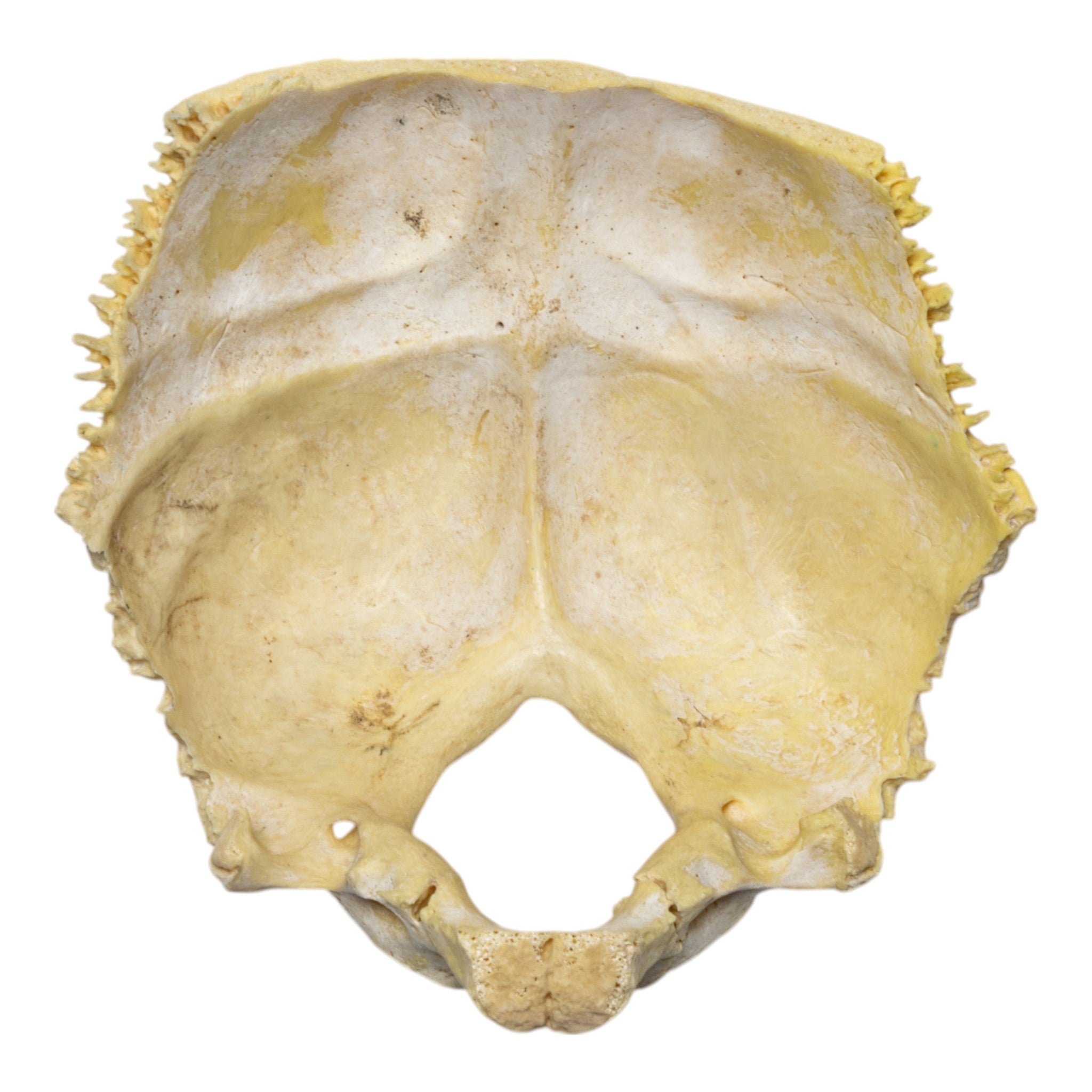 Authentic Human Child Occipital Bone Specimen - Medical Education, Anatomy Study & Forensic Science Training