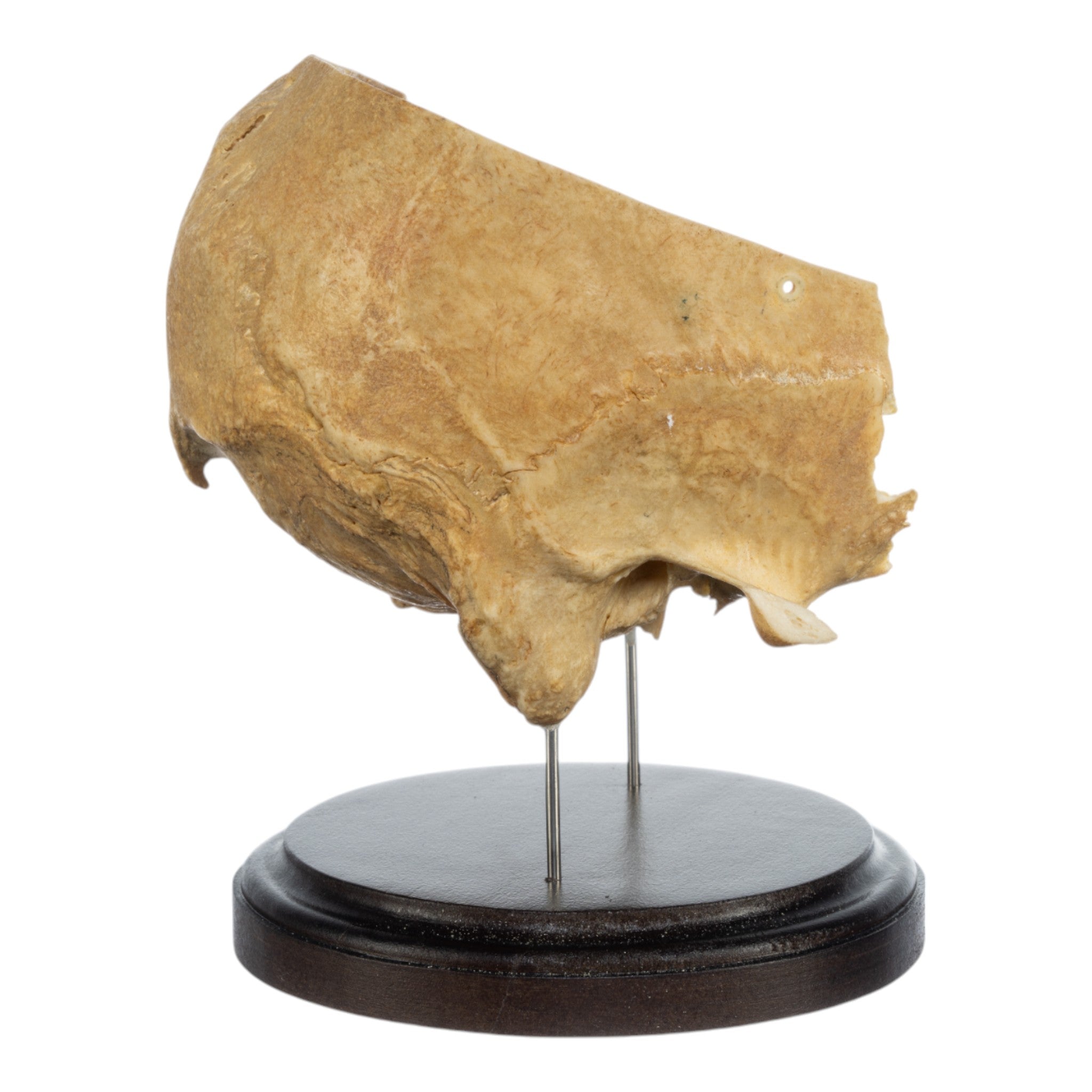 Real Human Partial Skull on Stand - Anatomical Model for Medical Study, Halloween Decor & Gothic Display - Perfect for Doctors, Students & Dark Aesthetic Collectors