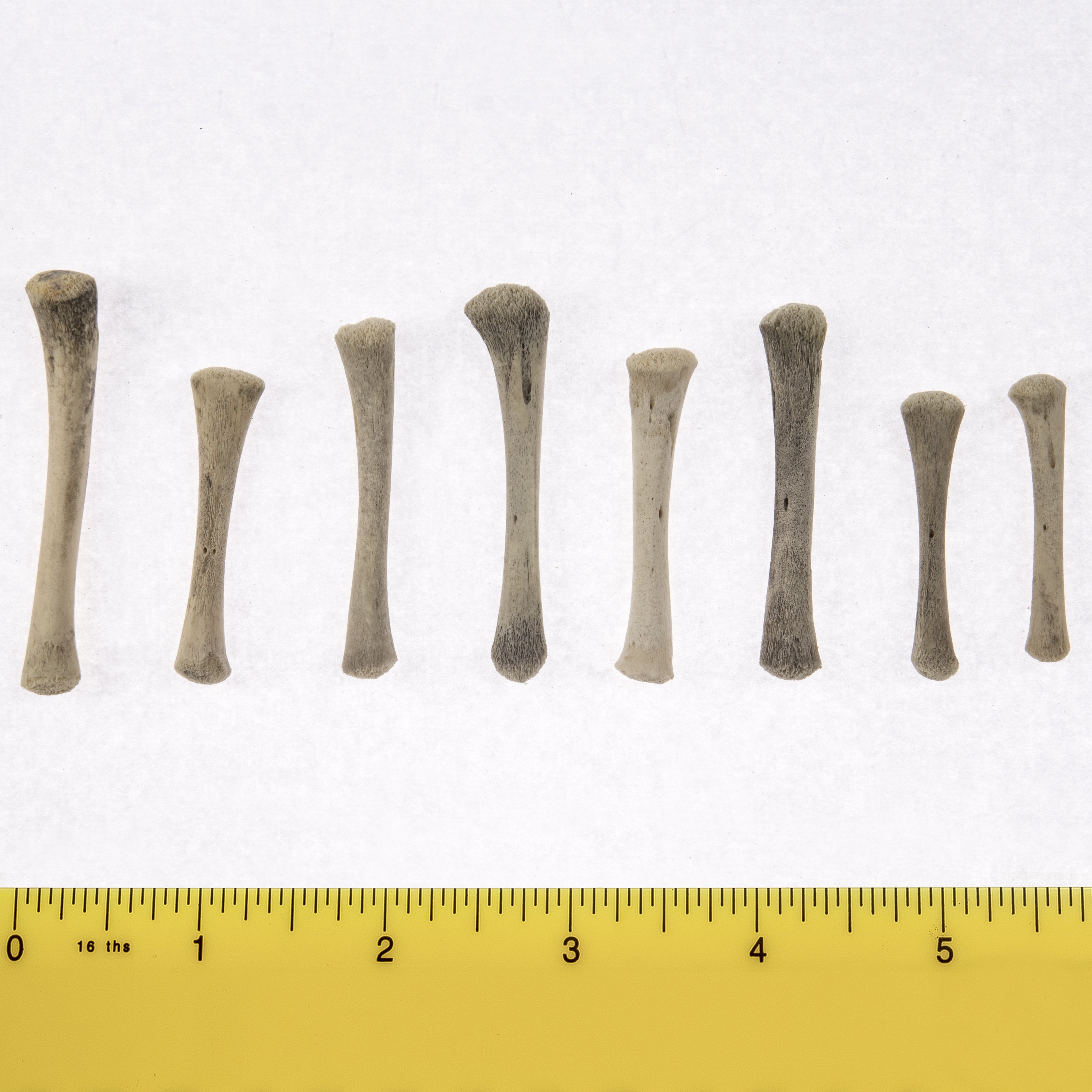 Premium Human Fetal Tibia Bone Specimen for Medical Research & Education - Ideal for Anatomy Studies, Pathology Labs, and Scientific Research