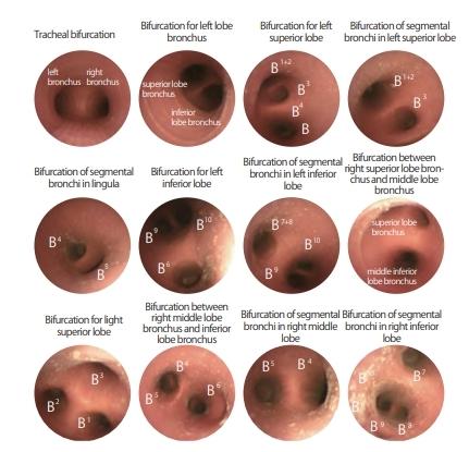 Difficult Airway Management Bronchoscopy Training Model - Realistic Medical Simulation for Anesthesia & Emergency Practice - Perfect for Medical Students, Residents, and Healthcare Professionals