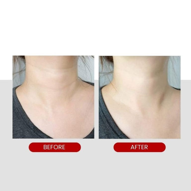 Medi Peel Premium 2.0 Collagen Night Thread Neck Cream - Anti-Aging Neck Firming Treatment for Wrinkles & Sagging Skin | Perfect for Nighttime Skincare Routine & Daily Moisturizing