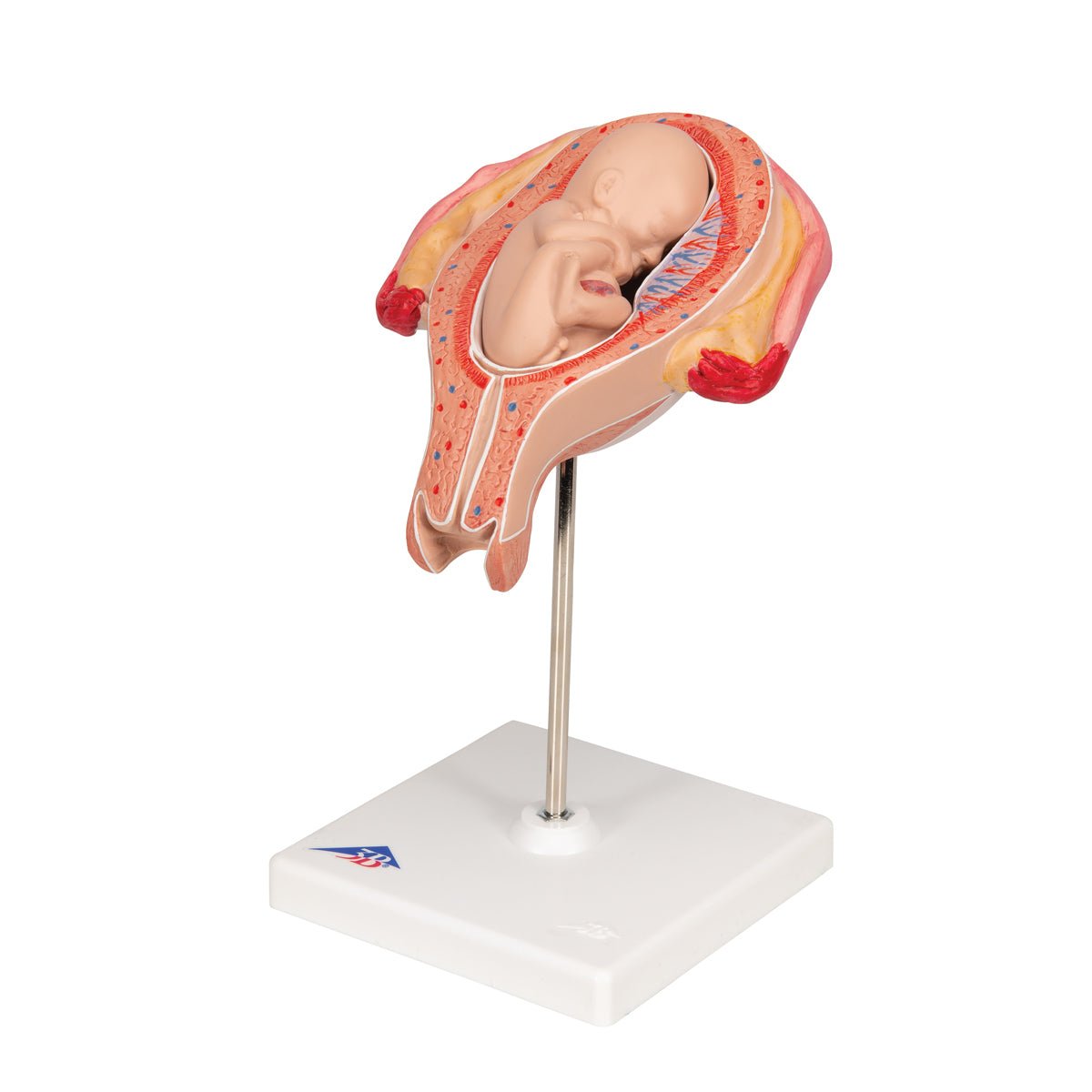 5-Month Fetus in Breech Position - Realistic Pregnancy Model for Medical Education & Training | Perfect for Obstetrics Students, Doctors & Midwives