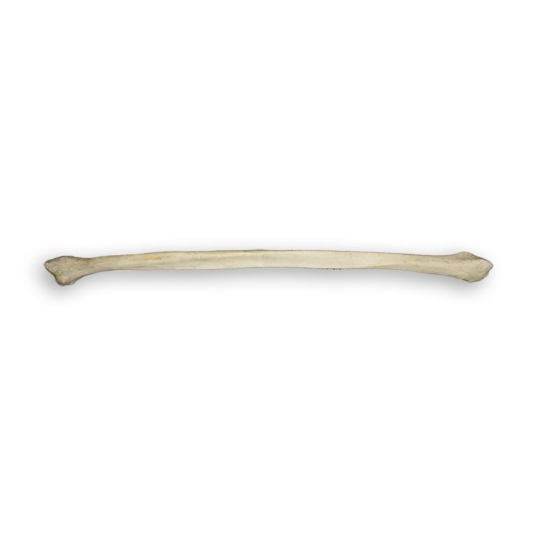 Real Human Fibula Bone - Authentic Medical Specimen for Anatomy Study, Research & Education - Perfect for Medical Students, Doctors & Science Enthusiasts