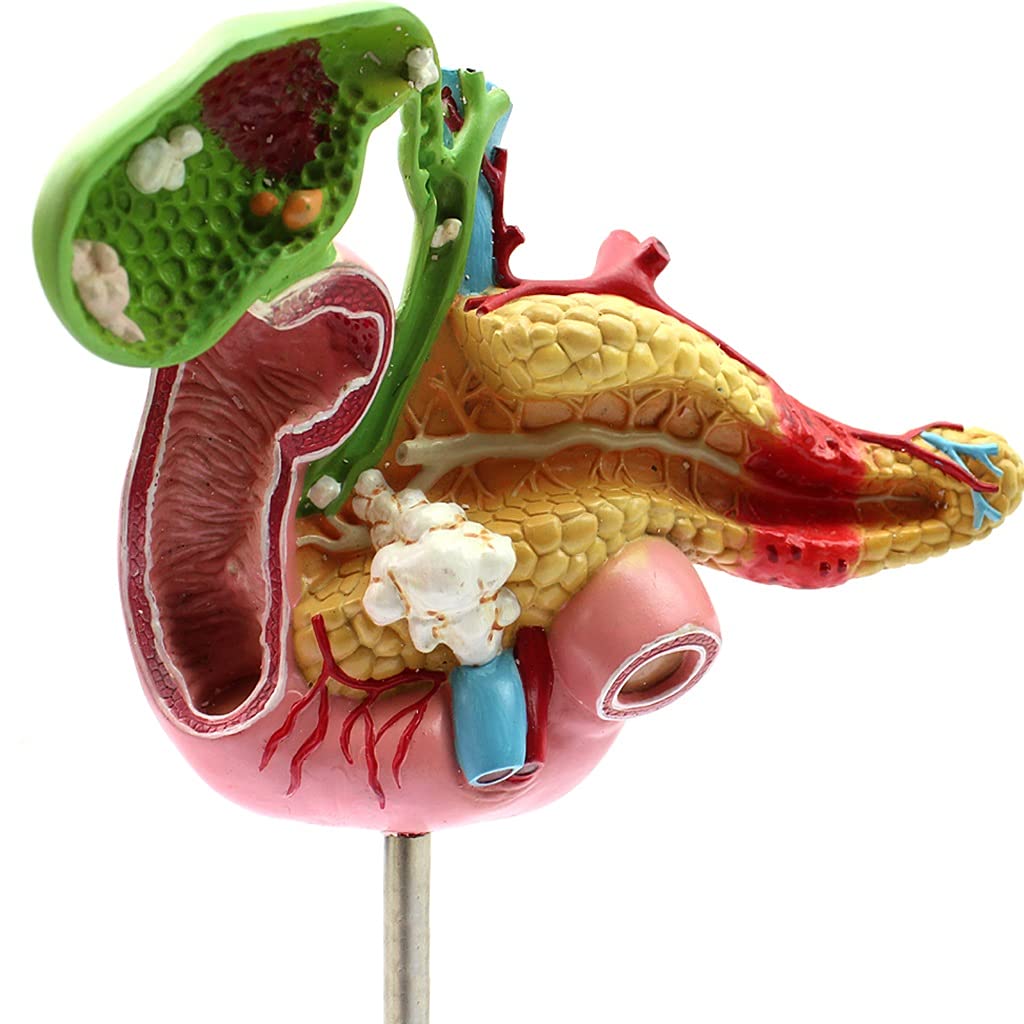 Life Size Pancreas Duodenum Pathological Model with Gallbladder - Anatomical Human Organ Model for Medical Lab Supplies, Classroom Teaching & Doctor's Office Demonstration