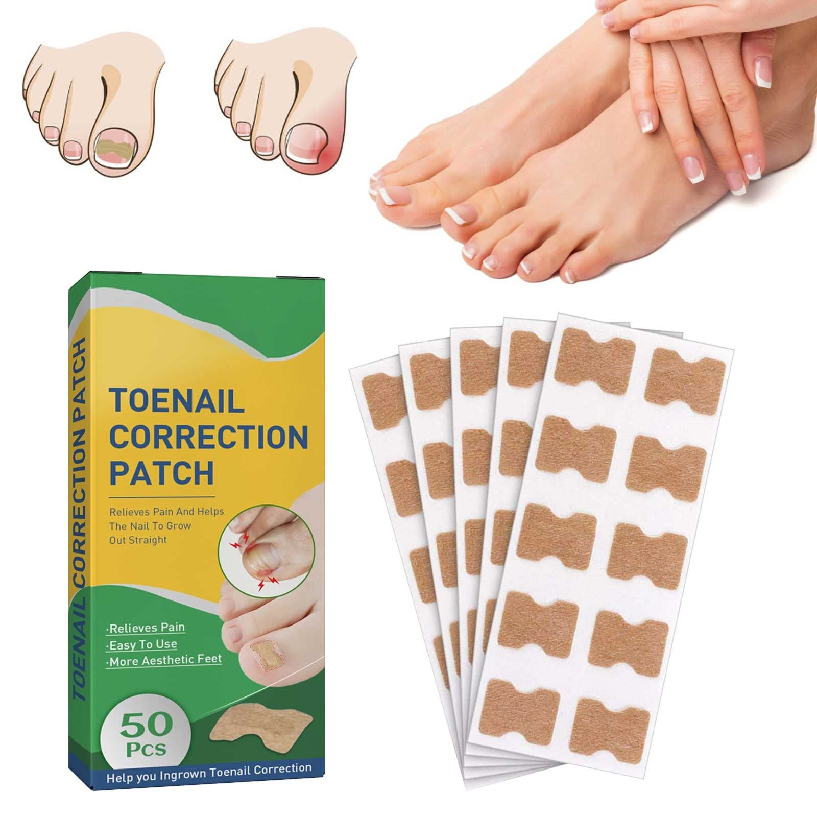 50pcs Curved Toenail Support Stickers - Nail Correction Patches for Ingrown Toenails & Manicure Care