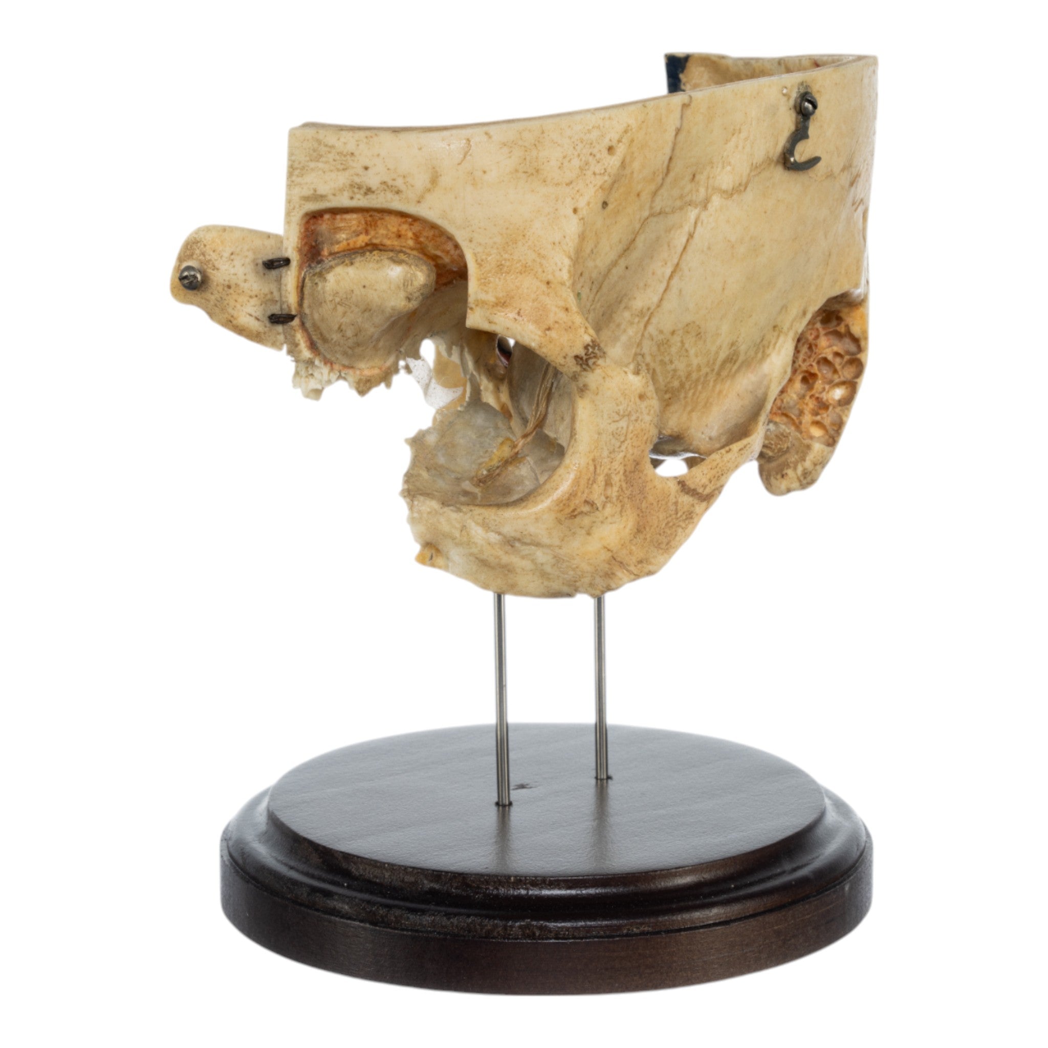 Real Human Partial Skull Replica with Display Stand - Perfect for Anatomy Study, Medical Education & Halloween Decor