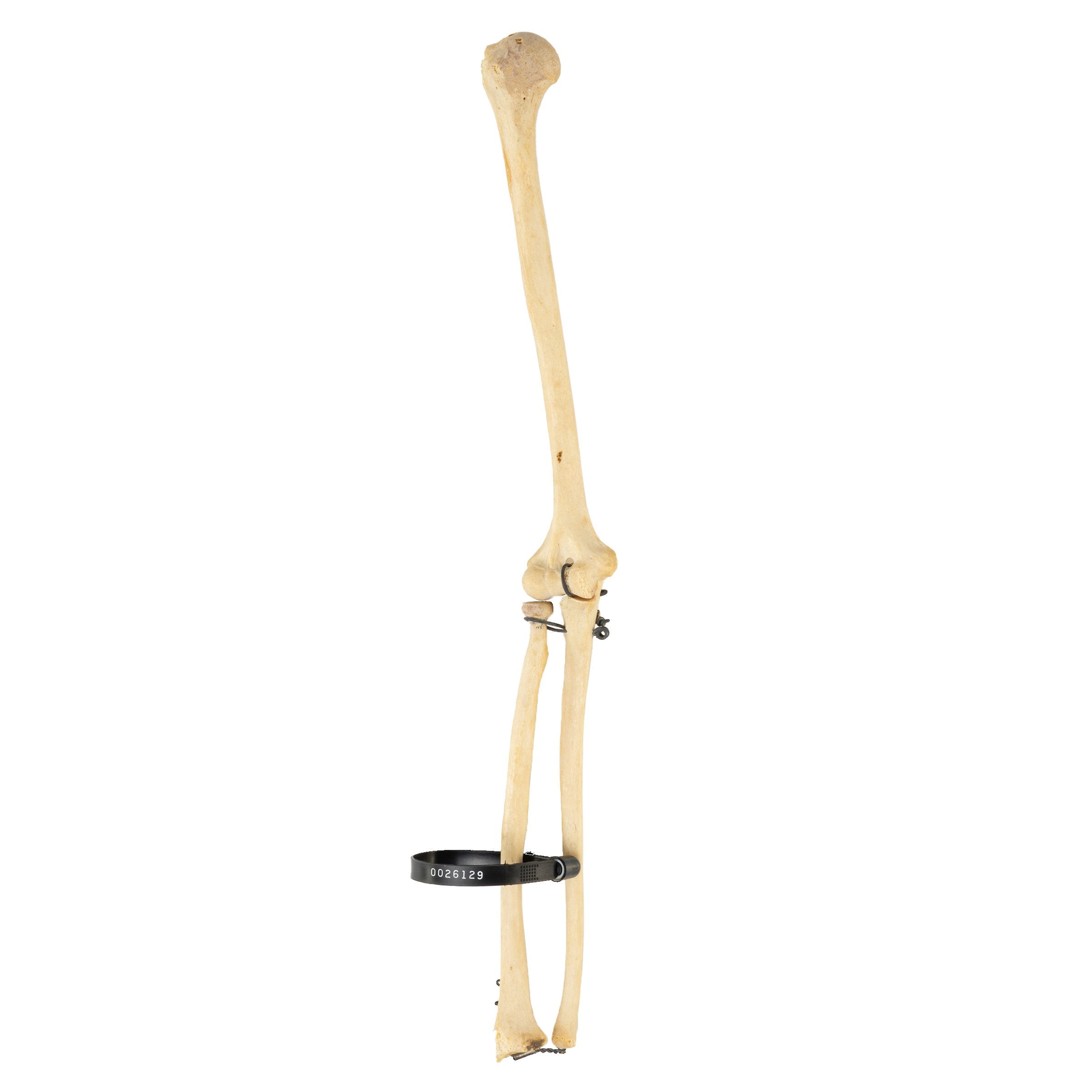 Authentic Human Humerus, Radius & Ulna Bones - Medical Study, Anatomy Education & Science Classroom Demonstration