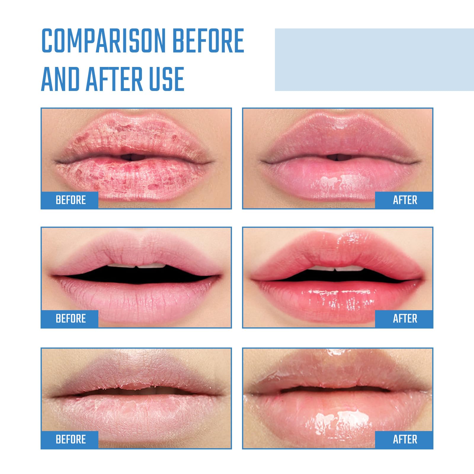 **Collagen Lip Mask - 6 Pieces Hydrating & Nourishing Lip Treatment for Dry & Chapped Lips | Moisturizing Lip Care Pads to Firm, Plump & Reduce Chapping | Perfect for Nighttime Lip Care & Pre-Makeup Prep (2 Pack)**