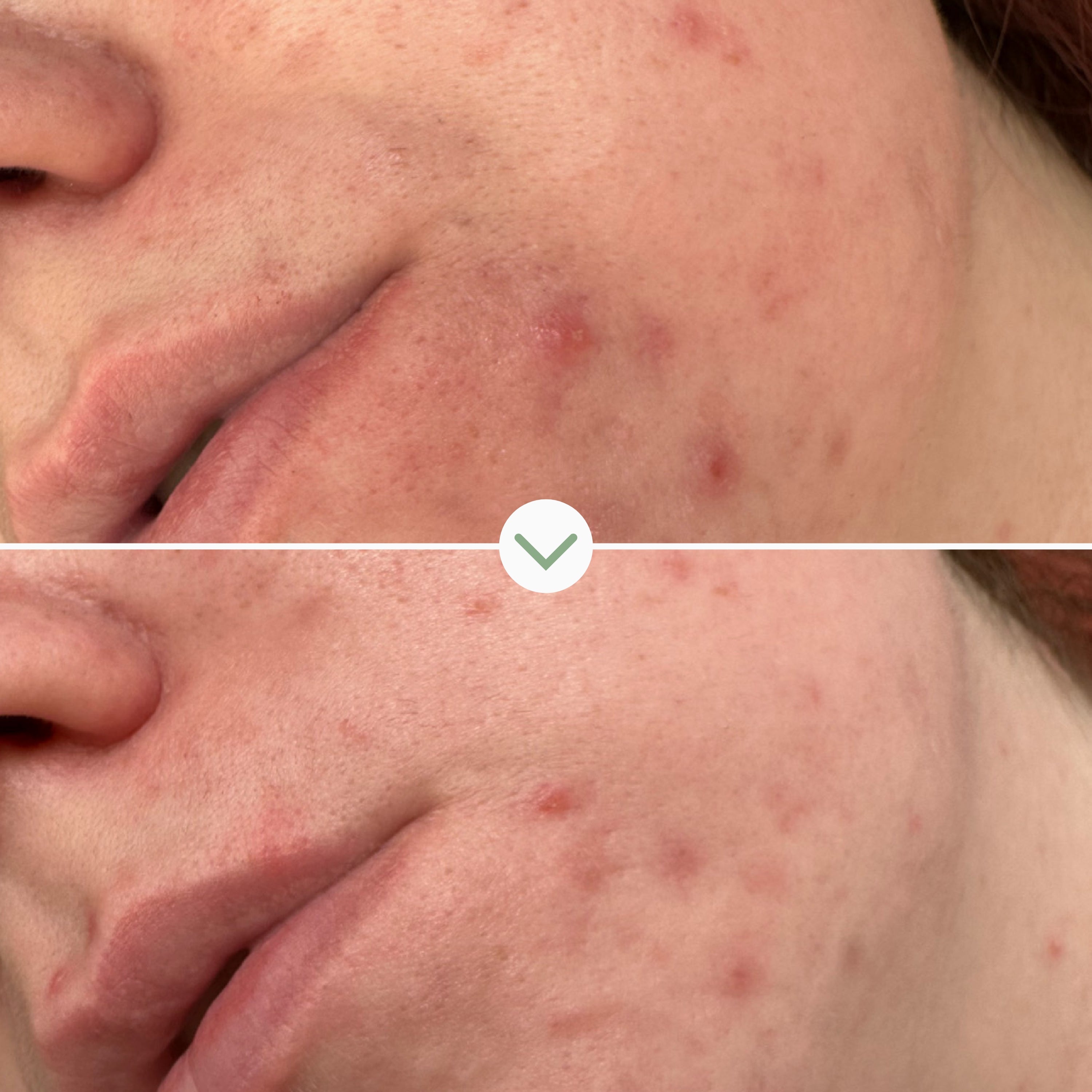 Phaze Rebalance Cleanser - Gentle Face Wash for Sensitive Skin | Hydrating & Soothing Formula | Perfect for Daily Skincare Routine & Post-Workout Refresh