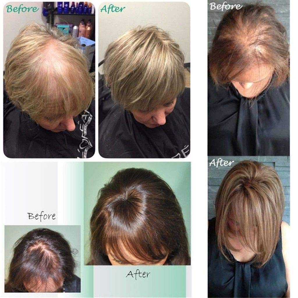 100% Remy Human Hair Silk Base Clip-In Hair Topper for Women - 14