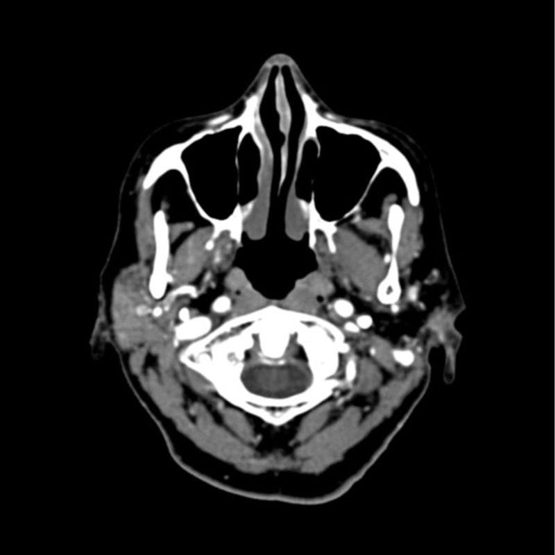 CTA Head Phantom for CT Scan & X-Ray Training - High-Quality Medical Imaging Education Tool for Radiology Students & Technicians
