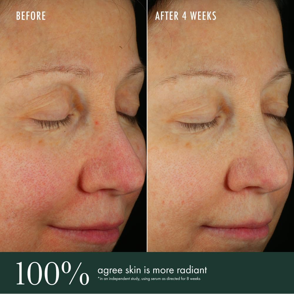 RéVive Brightening Serum with Vitamin C, Niacinamide & Peptides - Even Skin Tone, Reduce Wrinkles & Refine Texture | Day & Night Anti-Aging Skincare for Glowing Complexion