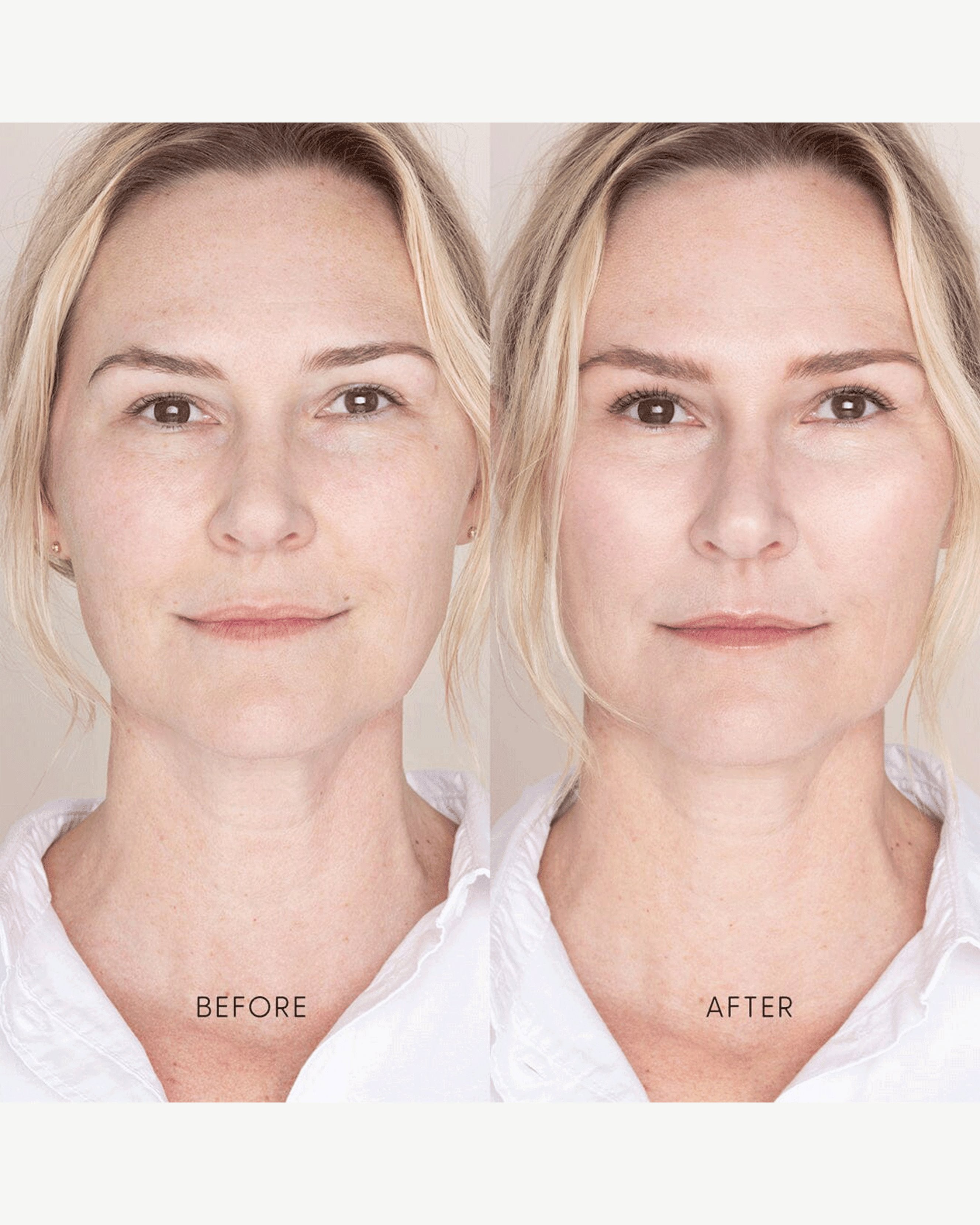 Best Skin Days Treatment Concealer - Full Coverage, Hydrating & Long-Lasting | Perfect for Dark Circles, Blemishes & Everyday Makeup Routine