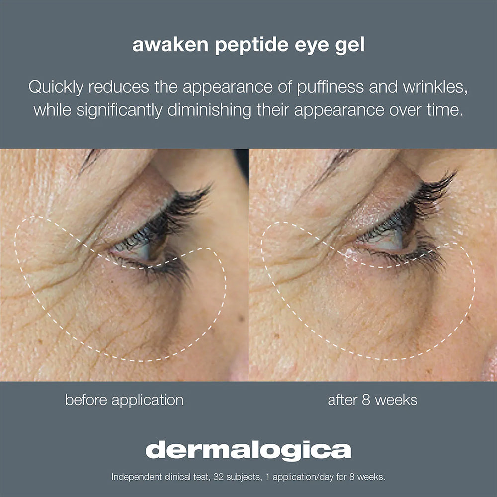 Dermalogica Awaken Peptide Depuffing Eye Gel - Reduce Puffiness & Dark Circles, Anti-Aging Eye Treatment for Brighter Eyes | Perfect for Morning Routine & Travel Skincare