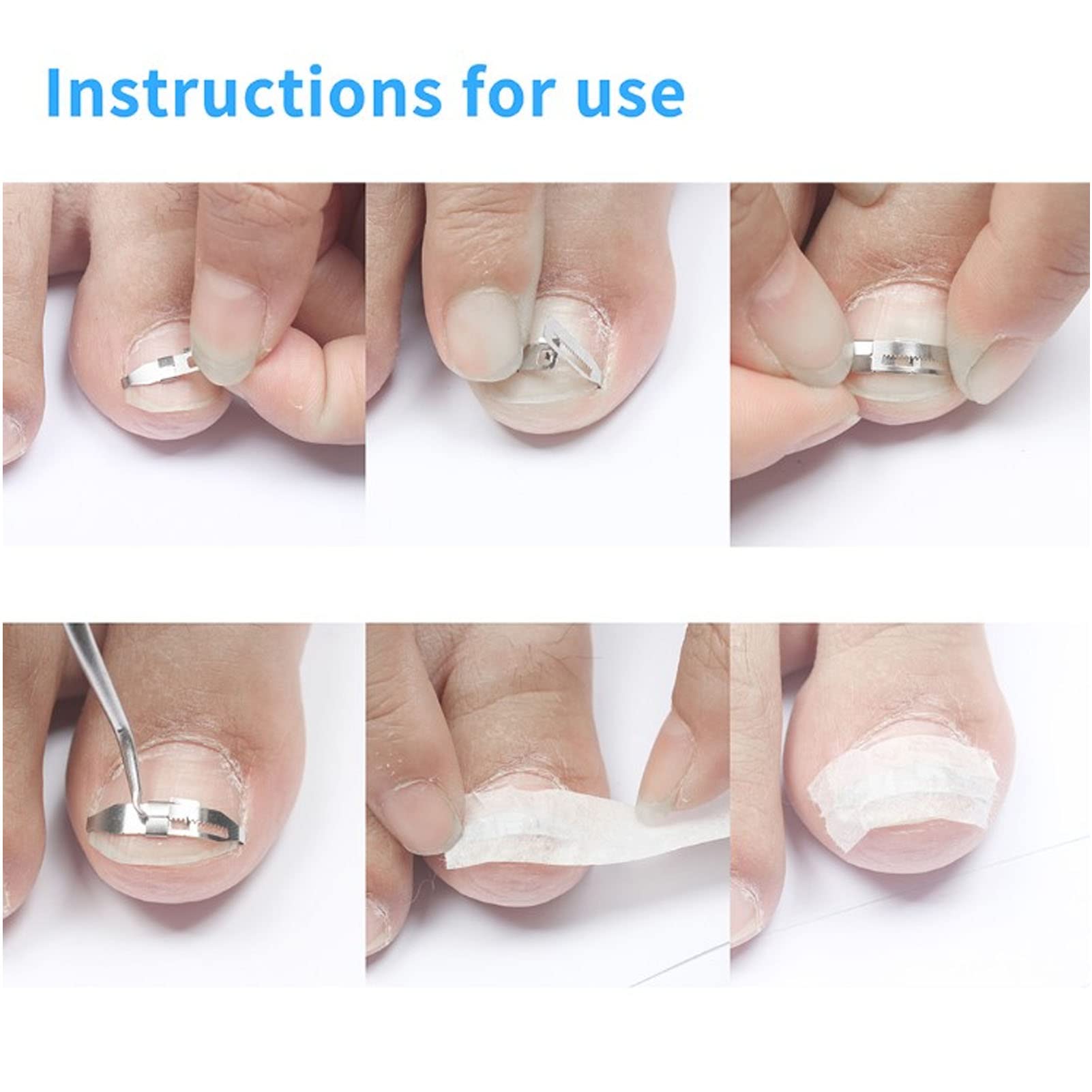 Yosoo Health Gear Stainless Steel Ingrown Toenail Corrector - Paronychia Treatment Tool & Nail Care Patch for Pain Relief | Perfect for Home Pedicure, Toenail Correction & Foot Care Routine